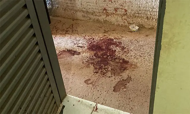 Idosa esfaqueada em Corumbá durante assalto teve mão amputada