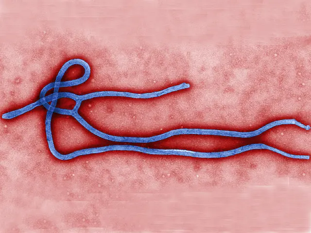 Secretaria de Saúde de MS apresenta Protocolo de Vigilância de casos suspeitos de Ebola