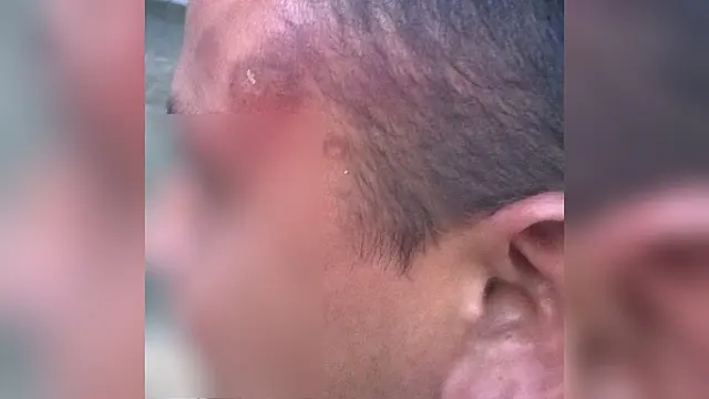 Três indígenas são atacados em aldeia de MS
