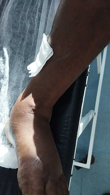 Homem é socorrido após picada de cobra no Pantanal