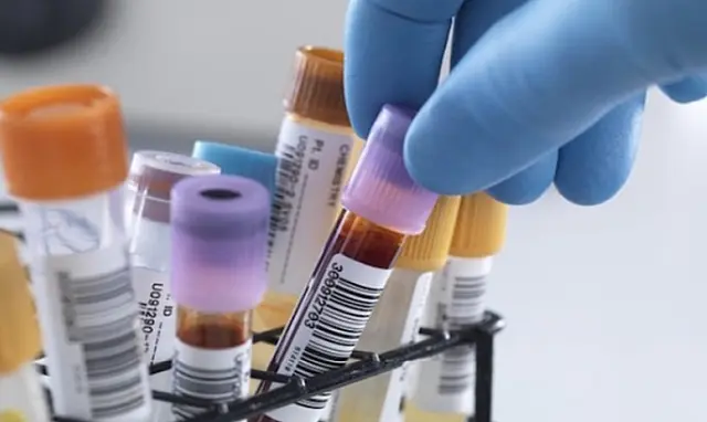 Manutenção em aparelho suspende exames bioquímicos em Bonito