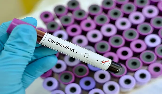Confirmados 5 novos casos de covid-19 em Aquidauana, de acordo com boletim epidemiológico