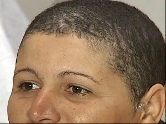 Careca após alisante, mulher quer processo