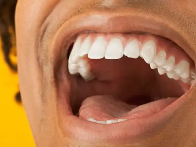 Doces e bebidas diets também prejudicam os dentes