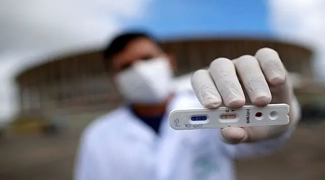 Secretarias municipais devem encaminhar resultados de testes rápidos da Covid-19 à SES