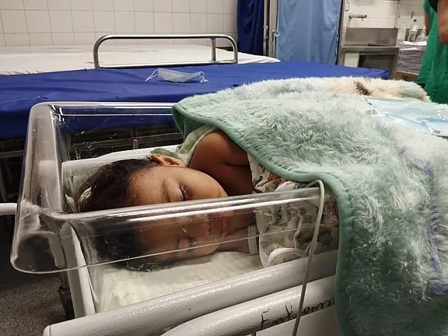 Hospital Universitário é o único de MS a realizar cirurgia de fissura labiopalatina