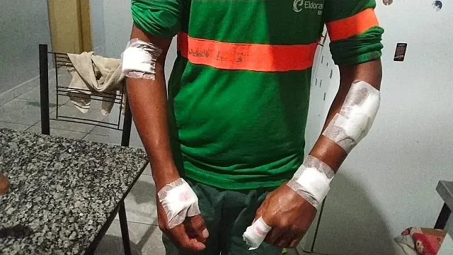 Cães soltos atacam coletor de lixo durante serviço em Anastácio