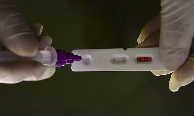 Brasil notifica 365 óbitos e 72 mil casos em 24h
