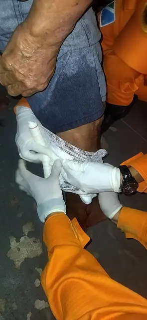 Idosa é atacada por cão da raça pitbull na rua em Corumbá