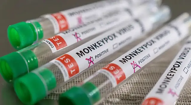 Brasil tem média de 40 a 50 novos casos de mpox por mês