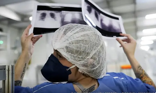 Câncer de pulmão em não fumantes preocupa especialistas