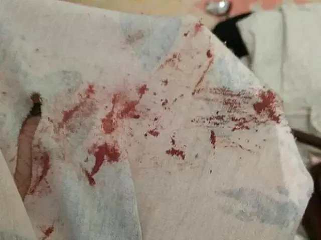 Dono de Pitbull nega ajuda à criança mordida