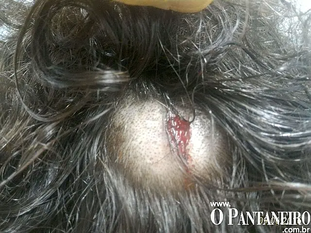 Noite sangrenta: PM da reserva de Ponta Porã atira em chapeiro e Policial Civil