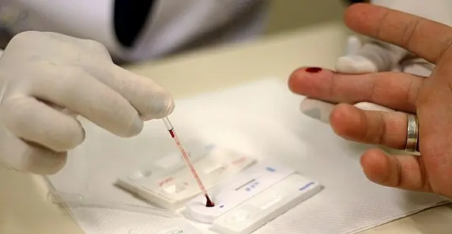 Anvisa aprova novo remédio para hepatite C