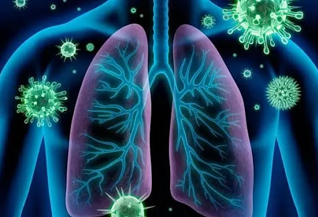 Aquidauana tem 70 notificações de síndrome respiratória