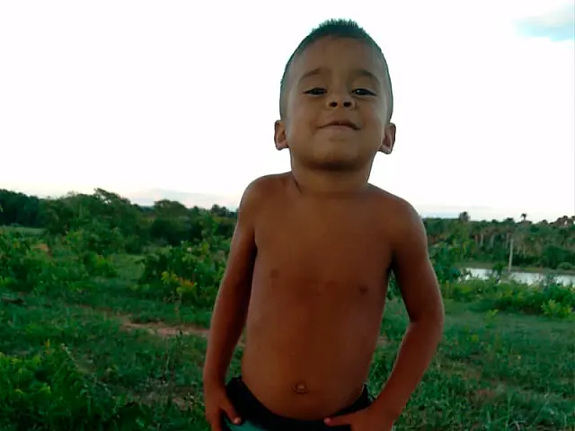 Ajude o pequeno Breno a conseguir sua cirurgia