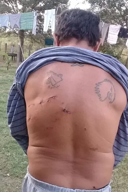 Atacado por onça em fazenda destaca cães que o salvaram: ‘são meus heróis’