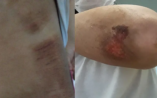 Motorista bêbado atropela jovens, tenta fugir, mas é preso pela Polícia Militar