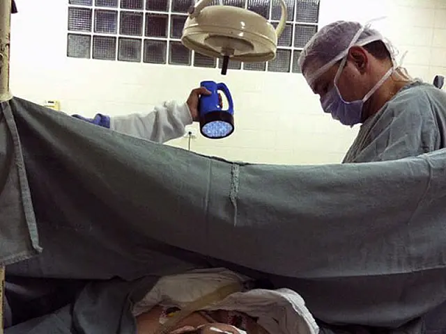 Sem aparelho, médico usa lanterna em cirurgia