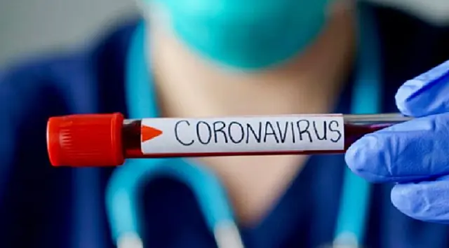 Mato Grosso do Sul tem 153 mortes por coronavírus e 12.969 confirmados