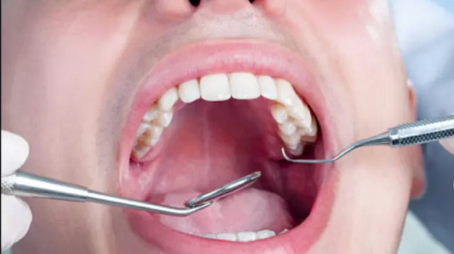 Dentista é denunciado à Polícia Civil de Bodoquena após procedimento 'incorreto'