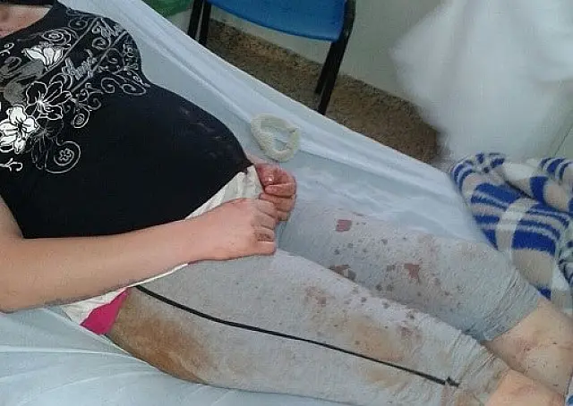 Grávida perde bebê depois de negar relações sexuais e ser espancada pelo marido
