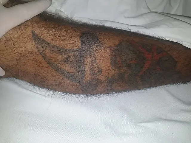 Hospital procura parentes de homem espancado em Campo Grande
