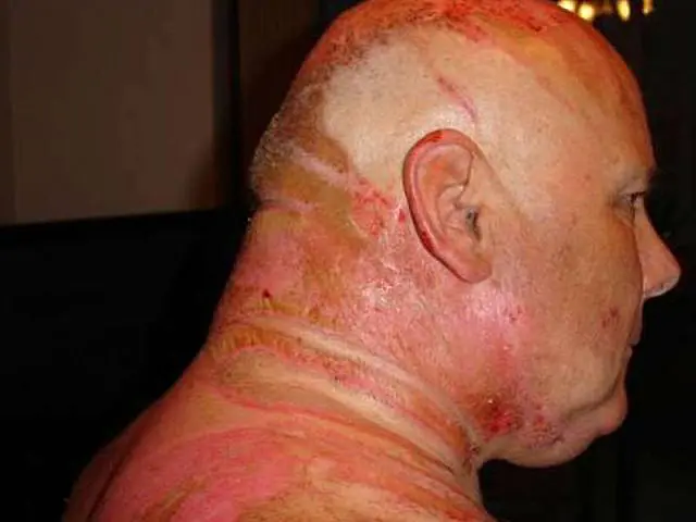 Mulher é condenada por tentar 'ferver' marido