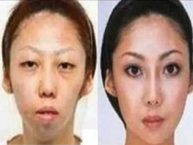 Chinês processa esposa porque ela fez plástica para ficar bonita