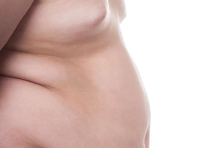 Brasil pode se tornar o país mais obeso do mundo, diz Ministério da Saúde