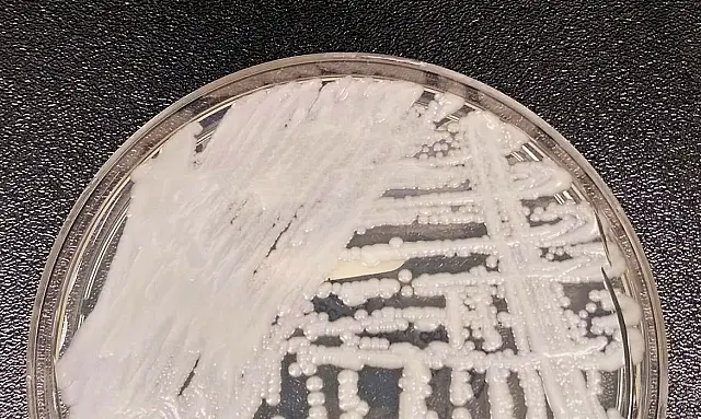 Anvisa confirma novo caso do superfungo Candida auris